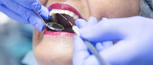 Best Emergency Dental Extractions in Fairview, MT